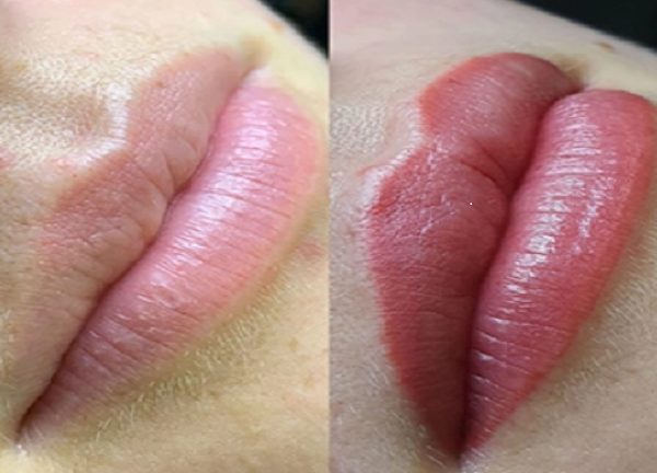 D&M Treatments - Lip Blush Tattoo