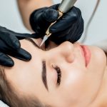what is Saline Tattoo Removal